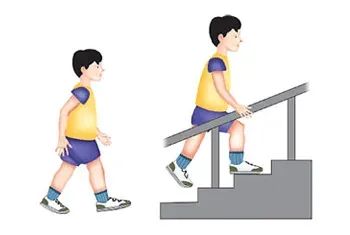 Illustration GMFCS Stufe II: Kind geht frei ohne Gehhilfen, benutzt Geländer zur Unterstützung beim Treppensteigen.
